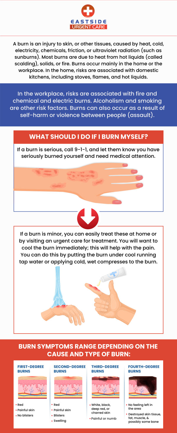Eastside Urgent Care is well equipped to handle most emergency situations including effectively treating burns from chemical or heat exposure. If you any level of burn from first degree to third degree, please consult a specialist for better care and treatment. Walk-in today or contact us to schedule a same-day appointment to avoid wait time. We are conveniently located at 988 Ohio Pike, Cincinnati, OH 45245.