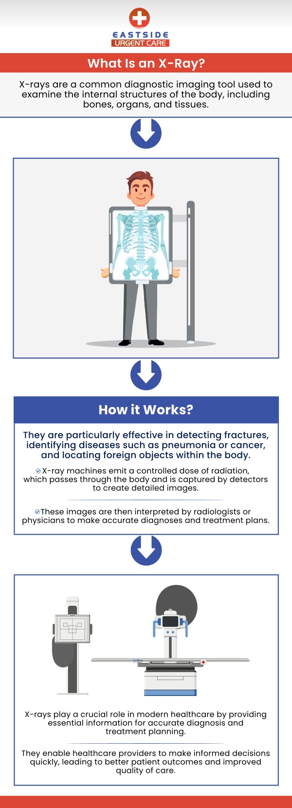 X-rays are a type of diagnostic imaging that uses radiation to create images of bones, organs, and tissues inside the body. The benefits of X-rays include that they are non-invasive, quick, painless, help diagnose a wide range of conditions, and require minimal radiation exposure. At Eastside Urgent Care, Dr. Noor U. Hassan, MD, and Dr. John Pressler, MD provide X-ray services that are intended to aid in accurately diagnosing a range of medical conditions. We offer X-ray services to patients of all ages and are dedicated to giving each patient a comfortable and secure atmosphere. For more information, contact us or book a same-day priority appointment. We are conveniently located at 988 Ohio Pike, Cincinnati, OH 45245.