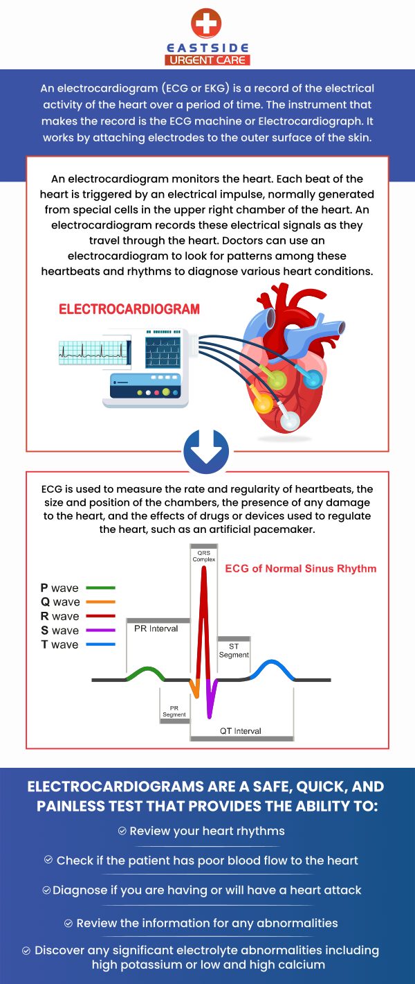 An EKG (electrocardiogram) is a medical test that records the electrical activity of the heart. EKG helps in diagnosing a variety of heart conditions including arrhythmias, heart attacks, and heart diseases. If you are looking for an EKG clinic, visit Eastside Urgent Care located in Cincinnati, OH. For more information, contact us or book a same-day priority appointment. We are conveniently located at 988 Ohio Pike, Cincinnati, OH 45245.