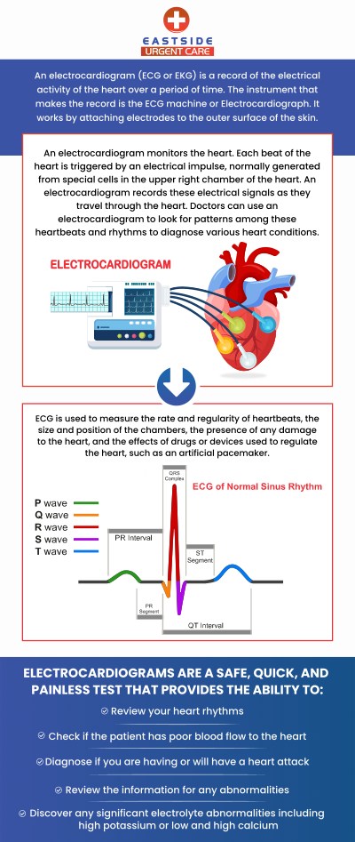 An EKG (electrocardiogram) is a medical test that records the electrical activity of the heart. EKG helps in diagnosing a variety of heart conditions including arrhythmias, heart attacks, and heart diseases. If you are looking for an EKG clinic, visit Eastside Urgent Care located in Cincinnati, OH. For more information, contact us or book a same-day priority appointment. We are conveniently located at 988 Ohio Pike, Cincinnati, OH 45245.